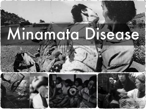 tragedi minamata jepang  Tahun 1976, sebanyak 120 penduduk Minamata meninggal dan 800 orang sakit karena keracunan ikan dan kerang yang terkontaminasi metil merkuri (MeHg)